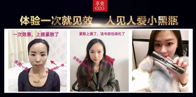 鄭州美博會(huì)_因V不凡，小黑瓶的魅力無法阻擋。